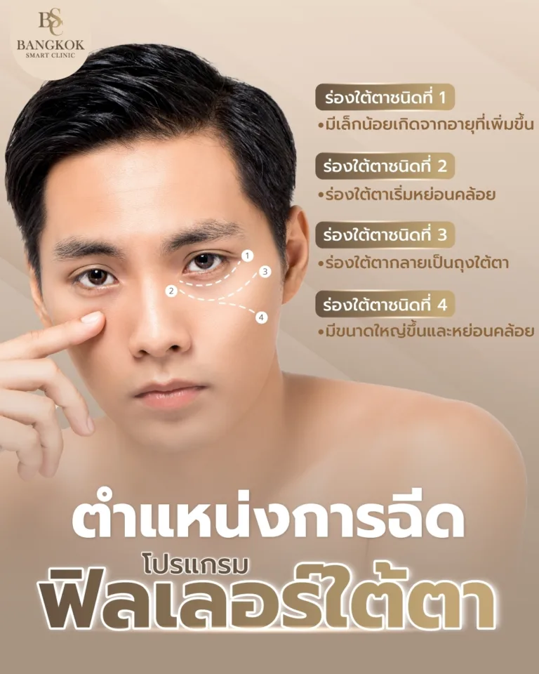 ฟิลเลอร์ใต้ตา