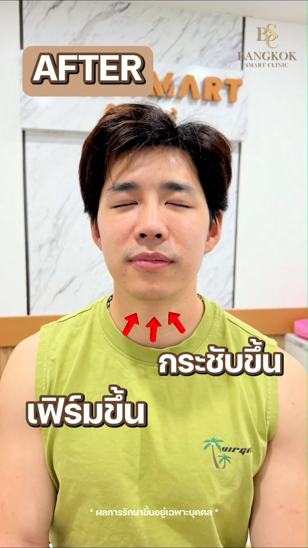 ใบหน้ากระชับ