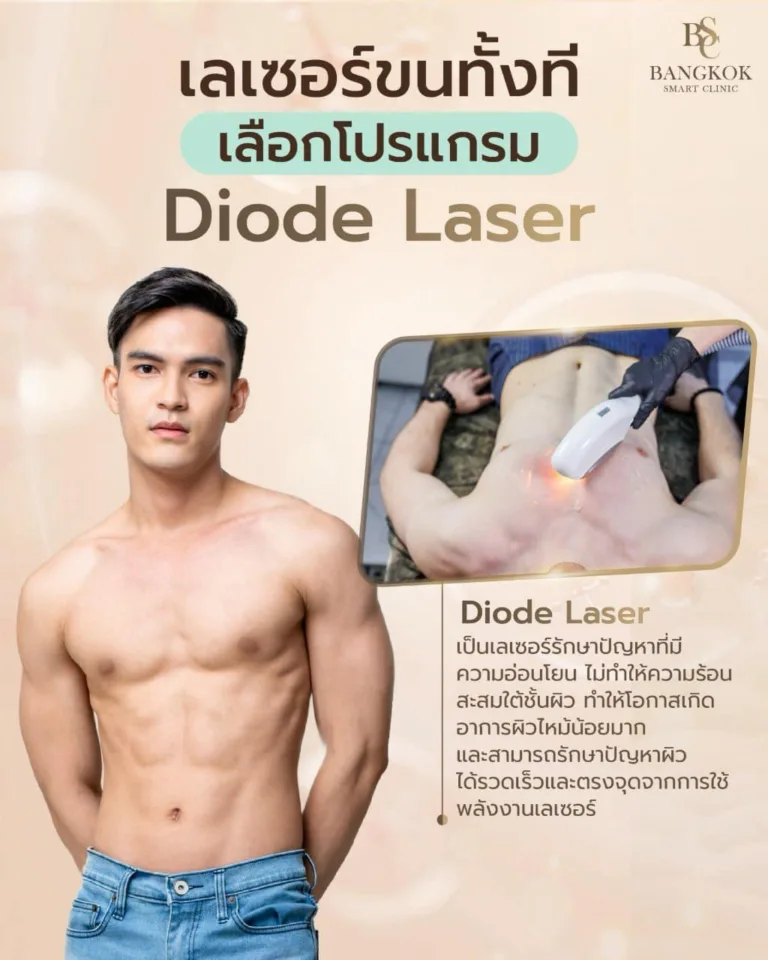 กำจัดขน