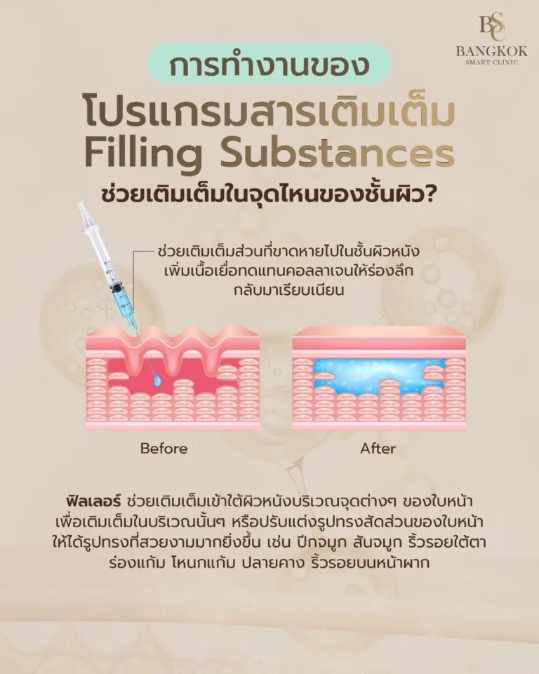 สารเติมเต็ม