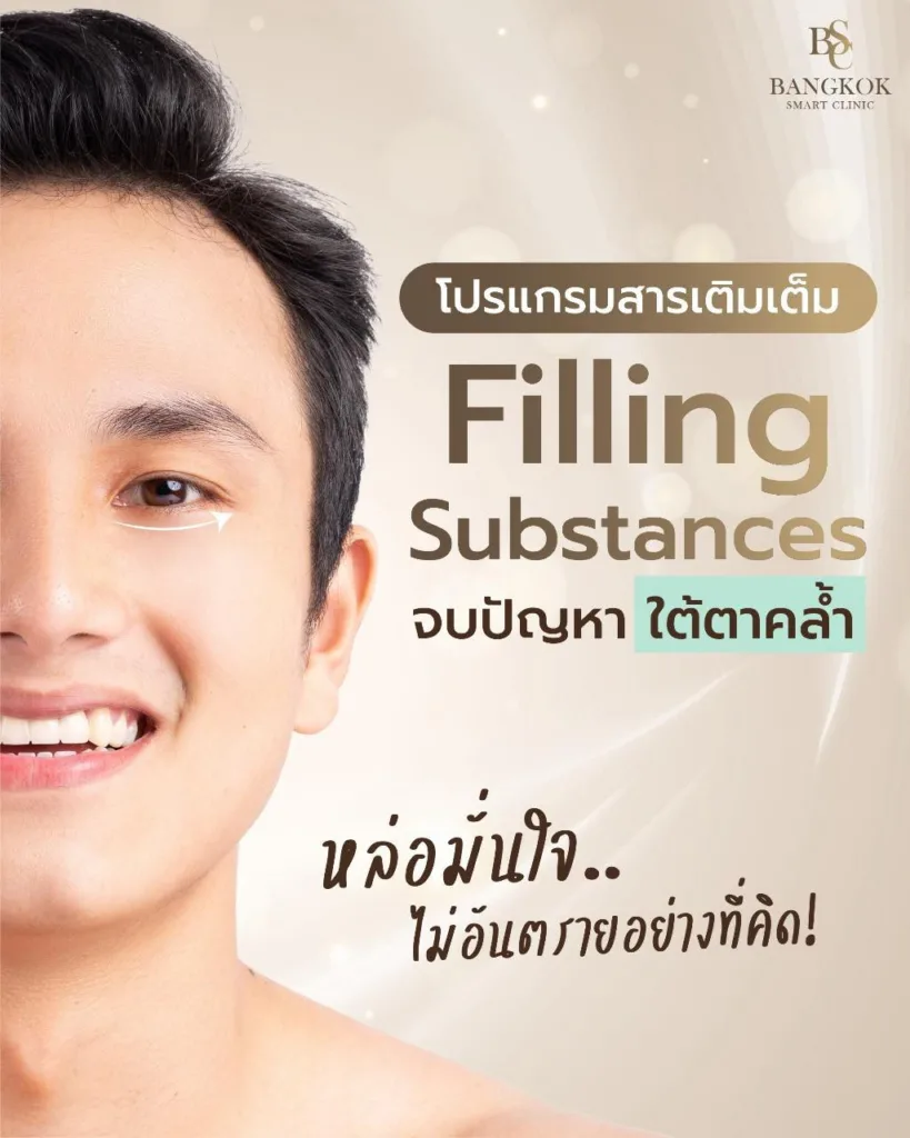 เติมเต็มร่องลึก