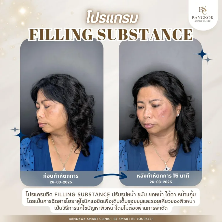 เพิ่มความมั่นใจ