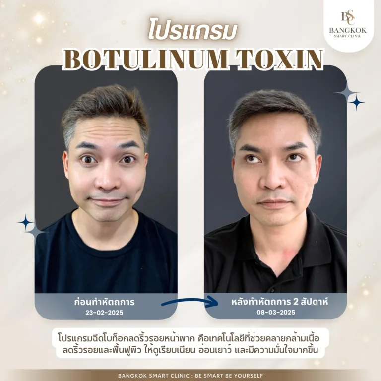 หน้าเนียนขึ้น