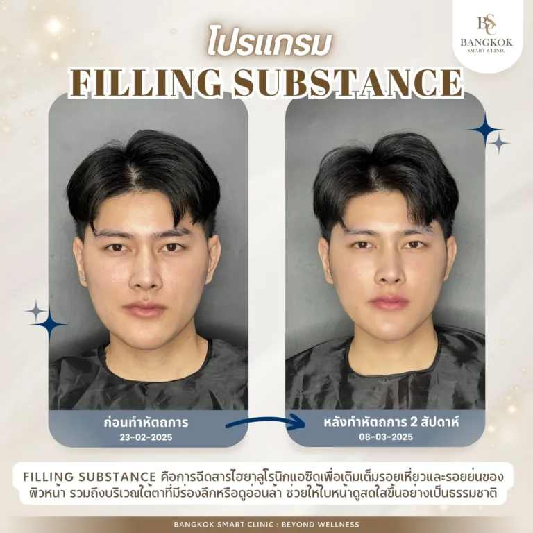 ปรับมิติใบหน้า