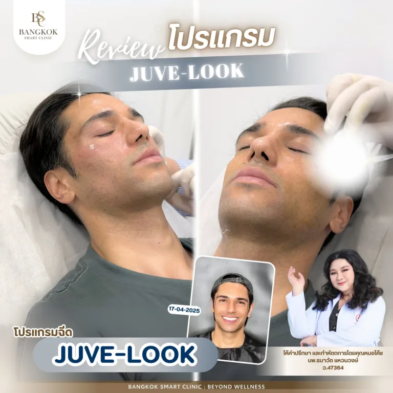 ใต้ตาหมอง