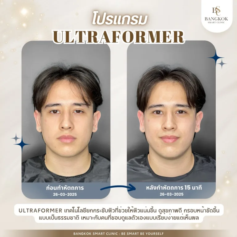 หน้าไม่เฟิร์ม