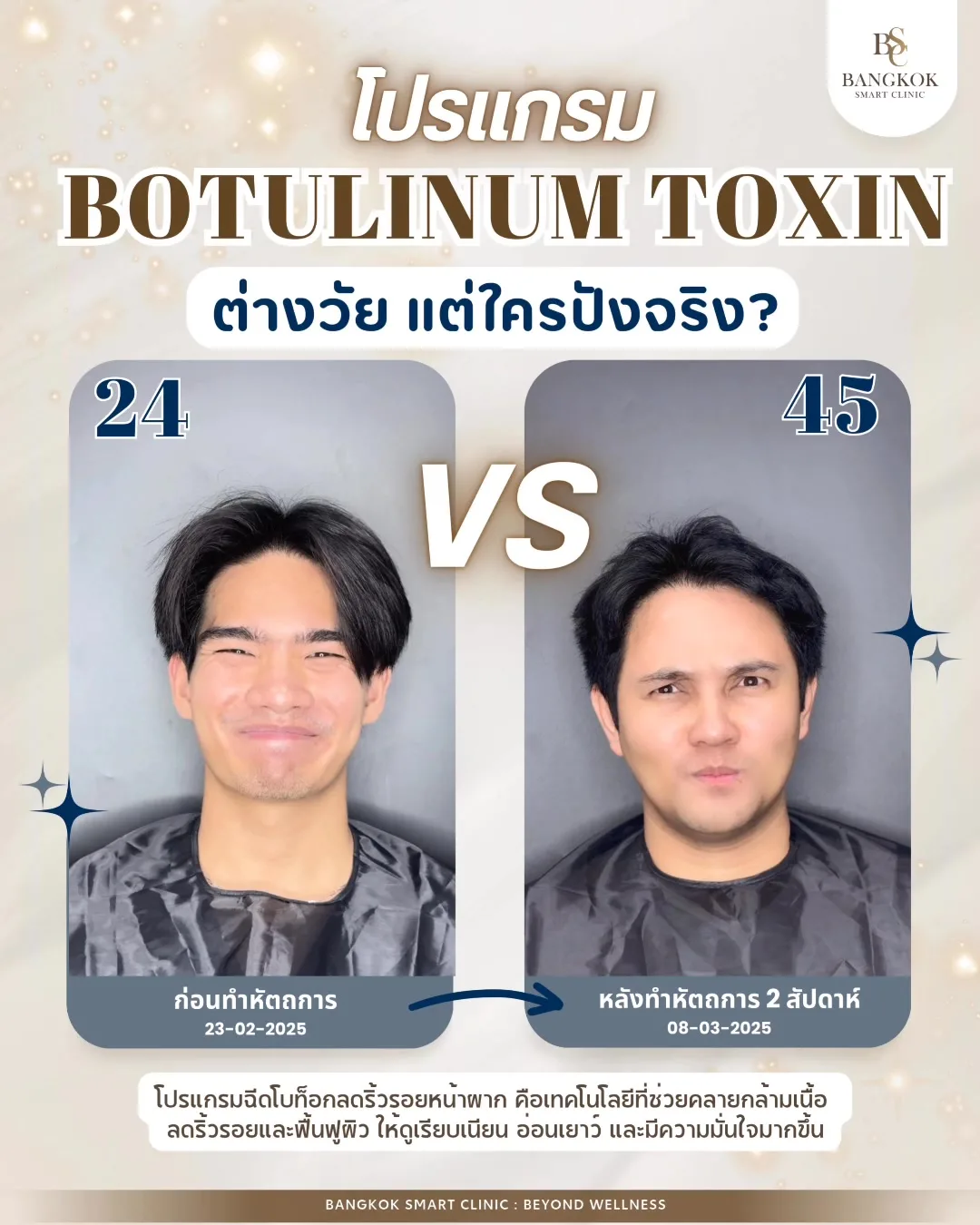 ริ้วรอย