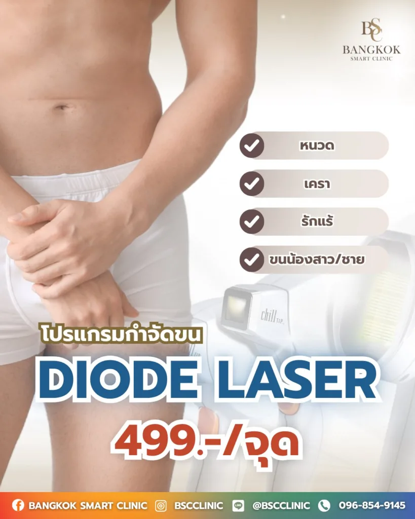 Diode Laser