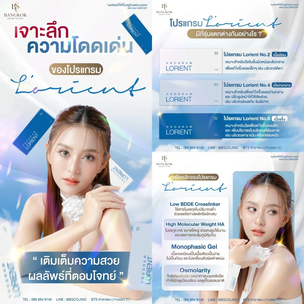 ฟิลเลอร์