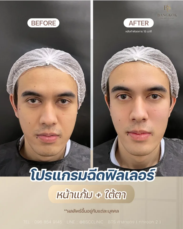 ใต้ตาลึก